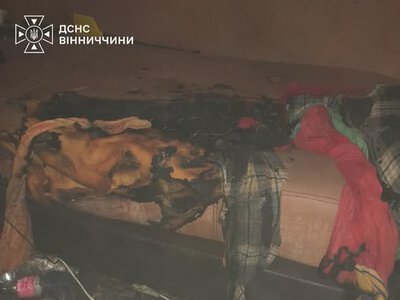 Через недопалок вінничанин опинився на лікарняному ліжку