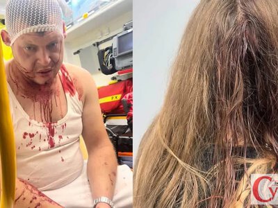 У Польщі знову побили трьох українців після суперечки через музику