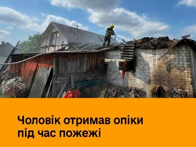 На Рівненщині під час пожежі господарської будівлі постраждав чоловік