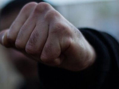 В Ужгороді сталася масова бійка: серед постраждалих — 16-річна дівчина