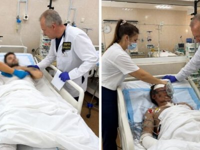 Ампутовані кінцівки та опіки: у Дніпрі рятують двох важкопоранених бійців