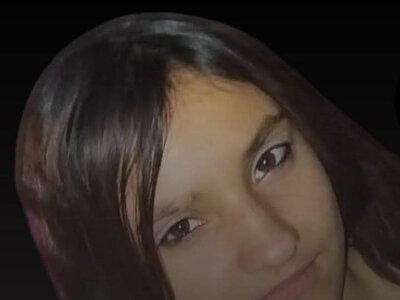 На Сумщині померла 13-річна дівчинка, яка понад місяць боролася за життя після російської атаки 