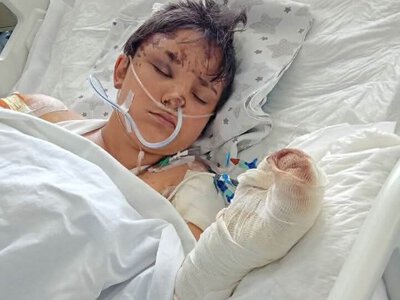 Понад місяць боролася за життя: у лікарні померла 12-річна Саша, поранена російським дроном
