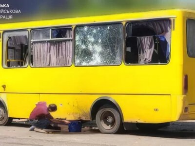 Що відомо про стан 15-річного хлопця, який постраждав від російської дронової атаки на маршрутку в Херсоні - Херсон Daily