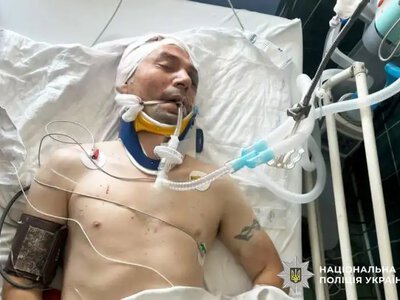 Невідомий велосипедист потрапив до лікарні після ДТП на Рівненщині