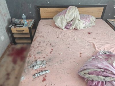 На Рівненщині в руках хлопця вибухнула граната, яку його батько привіз із зони бойових дій