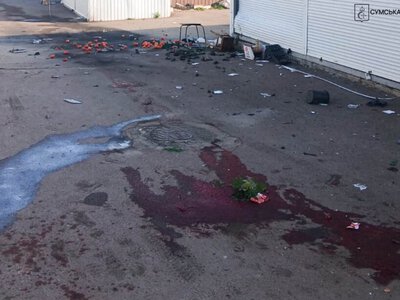 У лікарні помер літній чоловік, який був важко поранений під час удару по ринку в Білопіллі
