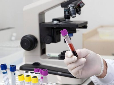 Підозри на гепатит, кашлюк і грибні отруєння: що кажуть епідеміологи  про ситуацію на Дніпропетровщині