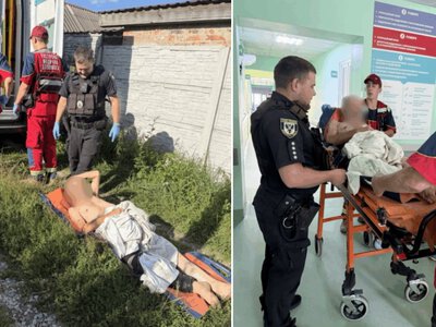 Прооперували і шукають прихисток: як громада у передмісті Чернігова рятує травмованого земляка