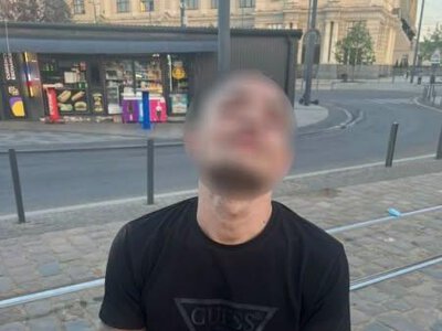 Житель Ужгорода у Львові пограбував жінку на інвалідному кріслі