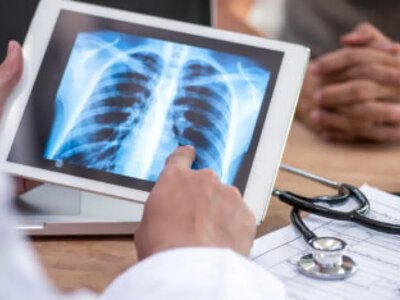 В Україні за місяць туберкульоз виявили у понад тисячі людей