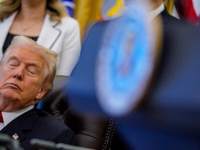 Синці, набряклі ноги та сонливість Трампа насторожили відомого кардіолога