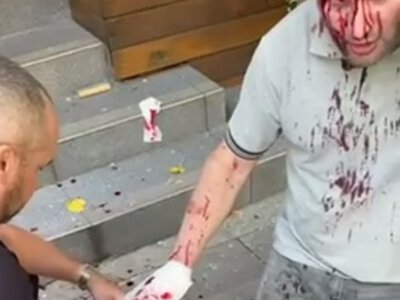 У Житомирі повідомляють про можливе влучання: у соцмережах пишуть про поранених
