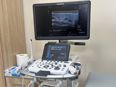 У поліклініці №1 запрацював новий ультразвуковий апарат експертного класу