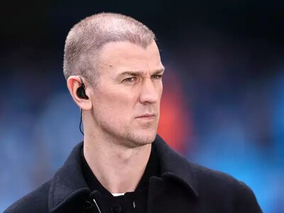 Легенда Ман Сіті зробив пересадку волосся та показав результат