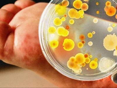 Дві жінки померли після відпочинку на природі: в Україні виявили небезпечну інфекцію