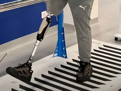 Протез є, але незалежність не завжди відновлена