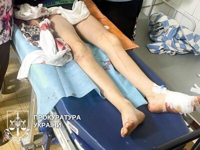 Ротвейлери покусали двох підлітків на Рівненщині: власника собак судитимуть
