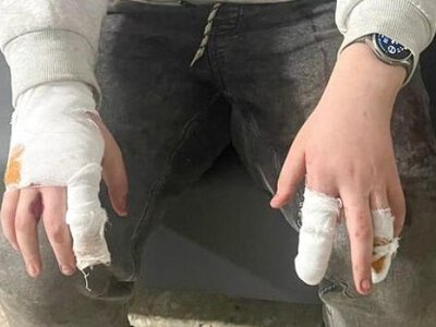 На Рівненщині судитимуть власника ротвейлерів, які покусали дітей