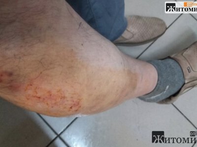 Через шість років після провалу підлоги в тролейбусі у Житомирі суд присудив пасажиру 64 тисячі гривень