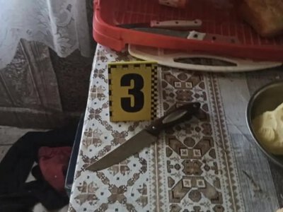 У селі Гірники Ратнівської громади жінка поранила ножем чоловіка: йому врятували життя