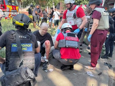 Чому ми розглядаємо фото після прильотів, навіть коли нам страшно: пояснює нейропсихологиня