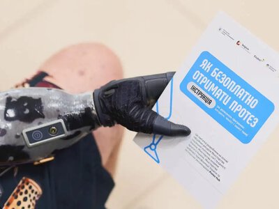 У 25 ЦНАПах на Рівненщині облаштували зони для зарядки протезів