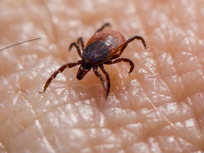 У Китаї відкрили новий небезпечний вірус: семеро заражених померли