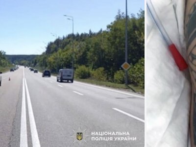 У реанімації без імені: біля Гуйви Mitsubishi збив чоловіка — поліція просить допомоги