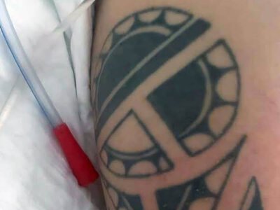 Поліцейські встановлюють особу травмованого після ДТП неподалік села Гуйви