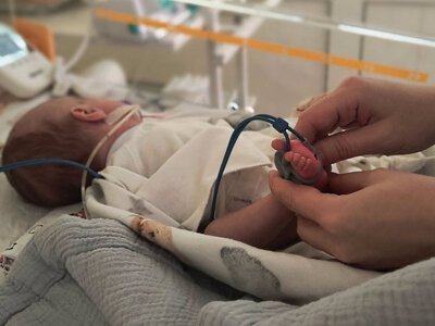 Пуповина зав’язалась у вузол: у Львові врятували немовля після важкої асфіксії