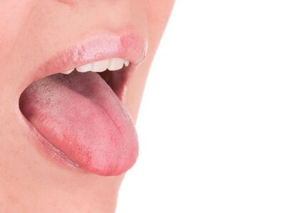 Особливості лікування стоматиту — основні відомості