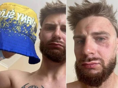 Поляка побили в Чехії, прийнявши його за українця — винним виявився капелюх