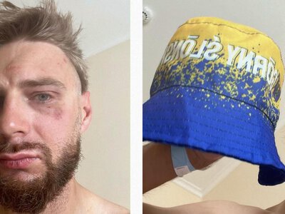 У Чехії поляка побили через панамку в кольорах прапора України