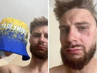 У Чехії поляка побили через жовто-синій капелюх: що відомо?