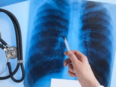 В Устилузі проведуть безкоштовну флюорографію