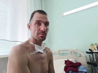 35-річний працівник “Парків Херсона” отримав тяжке поранення через атаку російського дрона - Херсон Daily