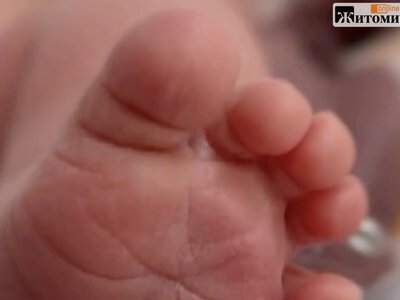 Другий малюк понад 5 кг за кілька днів: у Житомирі народилася дівчинка вагою 5 240 г