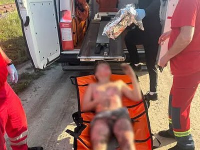 У Львові 13-річний хлопчик потрапив до реанімації після спроби зробити селфі на вагоні