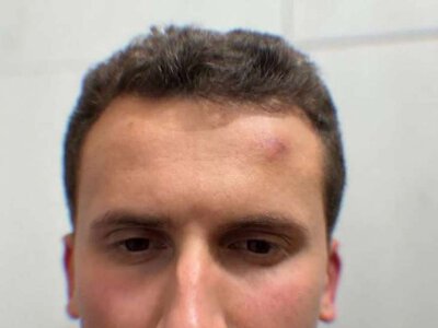 «Мене побив фігурант корупційних скандалів»: розробник дронів Тимофій Соловйов заявив про напад в орендованому будинку