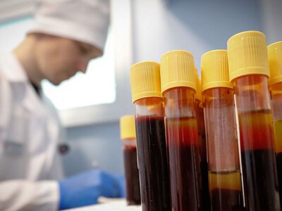 Пів століття загадки: вчені розкрили генетичну основу рідкісної групи крові MAL