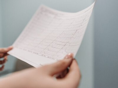 НСЗУ сплатила 35 мільйонів гривень медзакладам Сумщини за кардіохірургію