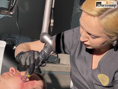У Житомирі постраждалі від війни можуть безкоштовно лікувати опіки та рубці — як подати заявку