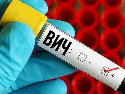 У Миколаївській області зростає кількість виявлених випадків ВІЛ: дані за вересень