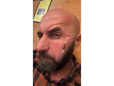 “На світлофорі дуже жорстко прийняв австрійський спецназ”, — Ярослав Бондаренко розповів подробиці затримання у Відні