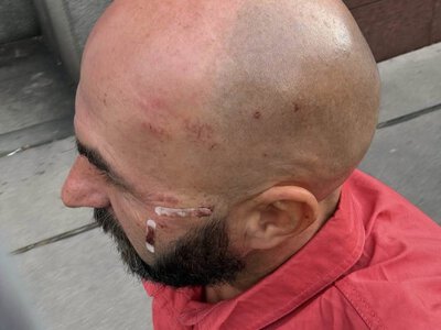 Було відчуття, що зараз зламають руку, – оператор Ткача про затримання в Австрії