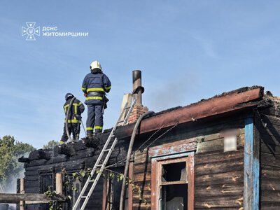 На Коростенщині внаслідок пожежі травмувався чоловік