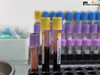 У Коростені за 726 тисяч гривень планують замовити 960 лабораторних послуг: що перевірятимуть