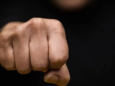 У Сарнах 20-річного чоловіка підозрюють у побитті місцевого жителя