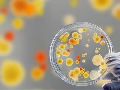 Лістеріоз в Україні: смертельна бактерія ховається у продуктах харчування